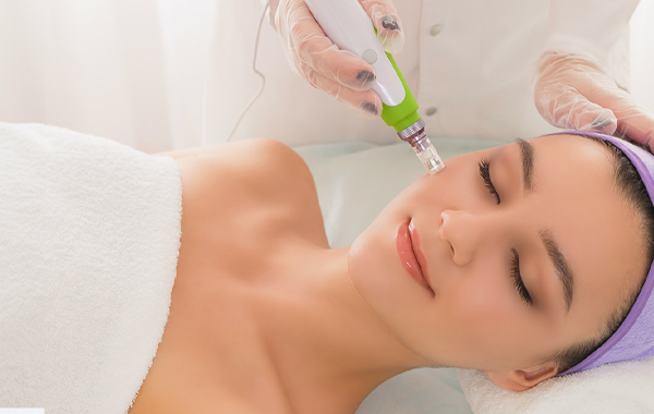 Micro Needling in Essex