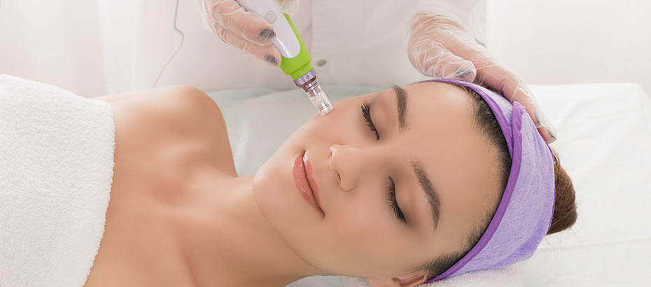 microneedling treatment